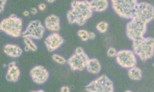 T24 人膀胱移行細(xì)胞癌細(xì)胞細(xì)胞保存