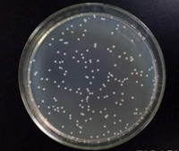 質(zhì)粒載體網(wǎng)SK-BR-3 [SKBR3]人乳腺腺癌細(xì)胞