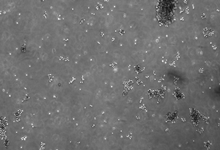 P815小鼠肥大細(xì)胞瘤細(xì)胞zlzt生物細(xì)胞庫