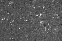 細(xì)胞購買NCI-N87 [N87]人胃癌細(xì)胞zlzt生物